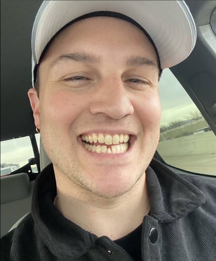 Sonrisa de un paciente antes del tratamiento